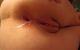 anal.lady